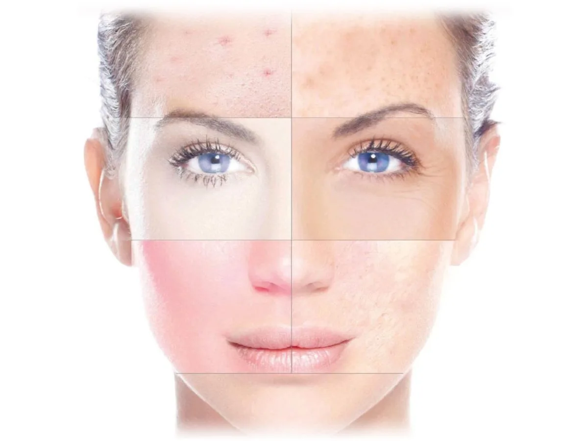 Cater-to-Different-Skin-Types - Vitamin F for Skin: Benefits & How to Use in Skincare 2026 - Zicail