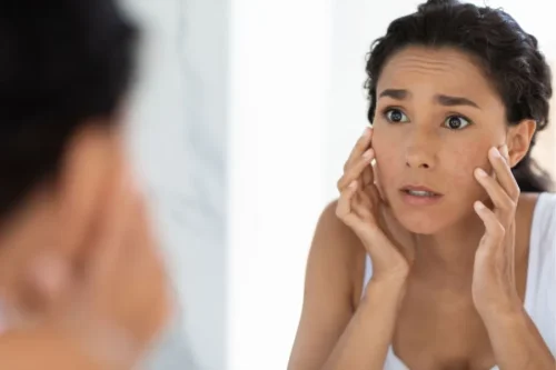 Woman looking at her skin with concern - Is Sunscreen Gluten-Free? Safe Options & Key Ingredients 2026 - Zicail Woman looking at her skin with concern - Is Sunscreen Gluten-Free? Safe Options & Key Ingredients 2026 - Zicail