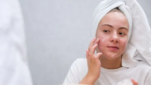 Acne prone skin sunscreen application for daily sun protection - Does Sunscreen Cause Acne? Myths, Facts & What Really Matters 2026 - Zicail Acne prone skin sunscreen application for daily sun protection - Does Sunscreen Cause Acne? Myths, Facts & What Really Matters 2026 - Zicail