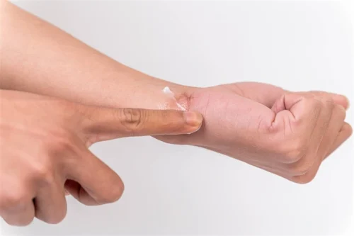 手首の小さな皮膚にクリームを塗る指 - 傷跡クリームの仕組みとは？効果と主要成分を解説 2026 - Zicail