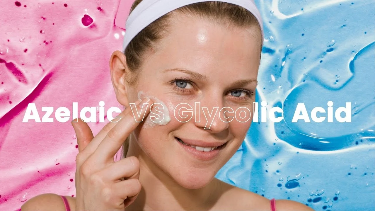 azelaic acid vs glycolic acid
