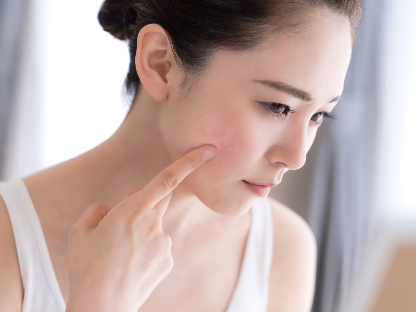 Collagen in skincare for sensitive or irritated skin - Soybean Oil for Skin: Benefits, Uses & Precautions 2026 - Zicail Collagen in skincare for sensitive or irritated skin - Soybean Oil for Skin: Benefits, Uses & Precautions 2026 - Zicail
