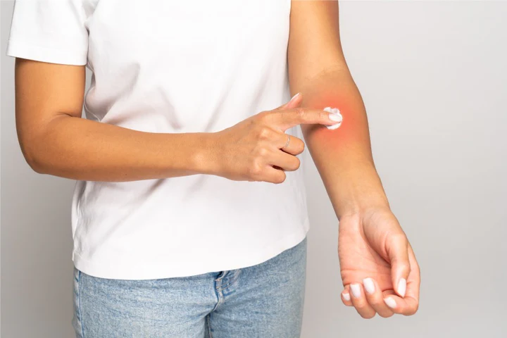 Hand applying moisturizer to the arm - Xylitol in Skincare: Hydration, Benefits & Uses Explained 2026 - Zicail