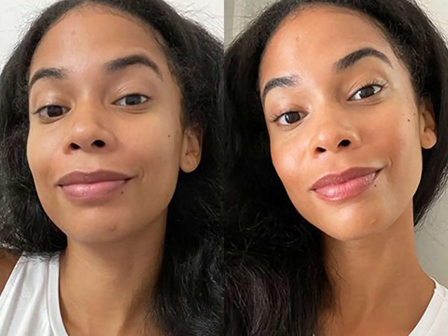 A woman showing her skin improvement after using linoleic acid - Linoleic Acid for Skin: Benefits, Sources & Tips 2026 - Zicail A woman showing her skin improvement after using linoleic acid - Linoleic Acid for Skin: Benefits, Sources & Tips 2026 - Zicail